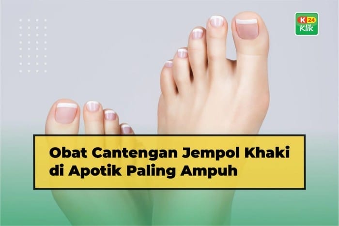 Cantengan obat kuku jempol shopee kaki Obat Cantengan Jempol Kaki Paling Ampuh